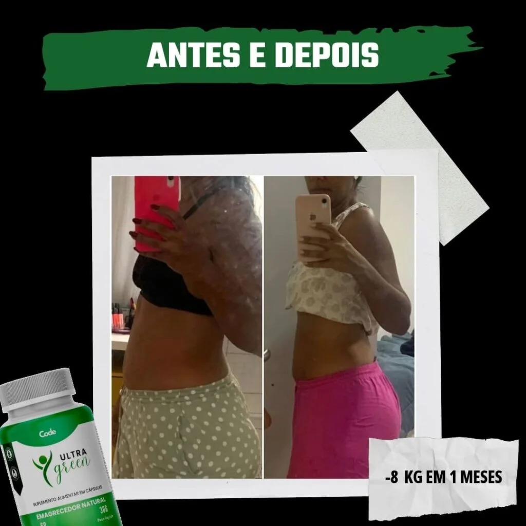 Ultra Green depoimentos. fotos de antes e depois.