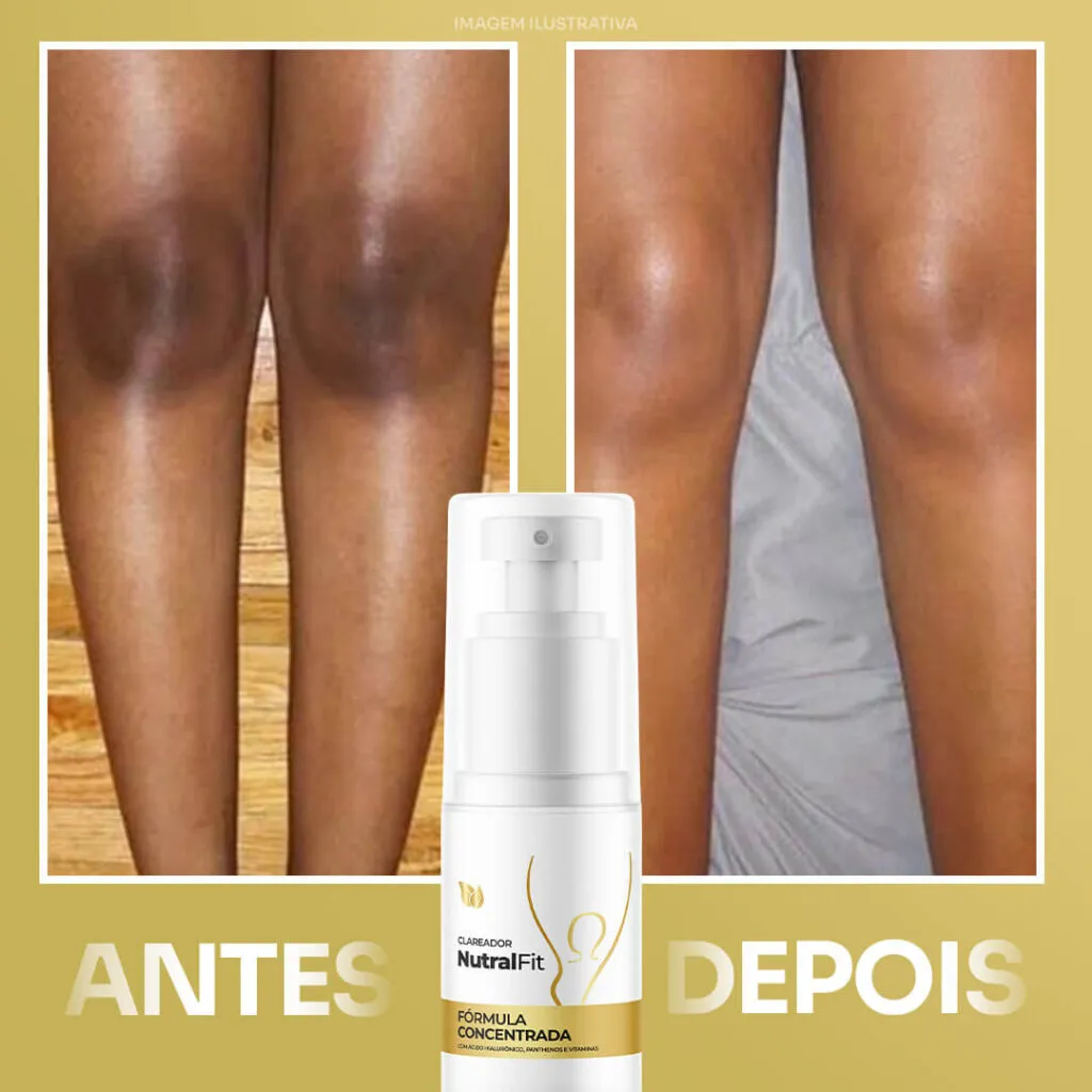 Depoimentos de clientes NutralFit. Fotos de antes e depois. Redução de manchas.