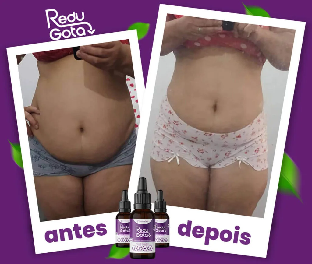 Redu Gota depoimentos de clientes. Fotos de antes e depois.