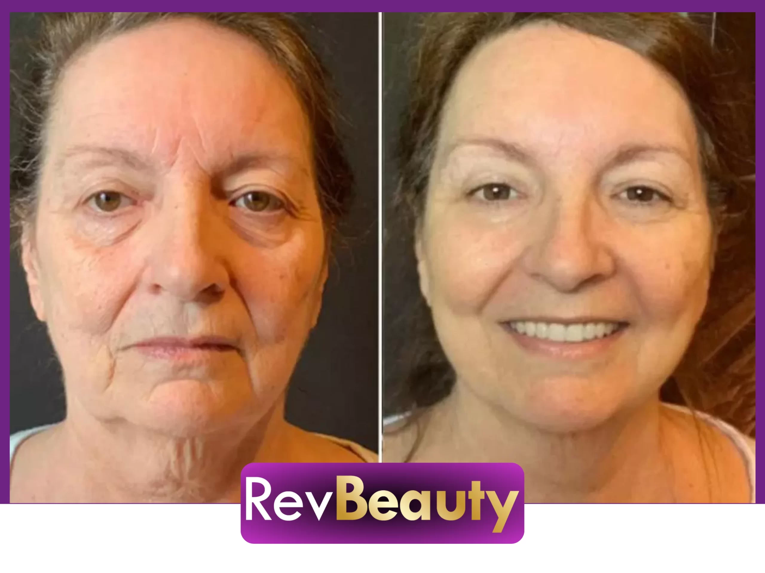 Resultados de clientes do RevBeauty.