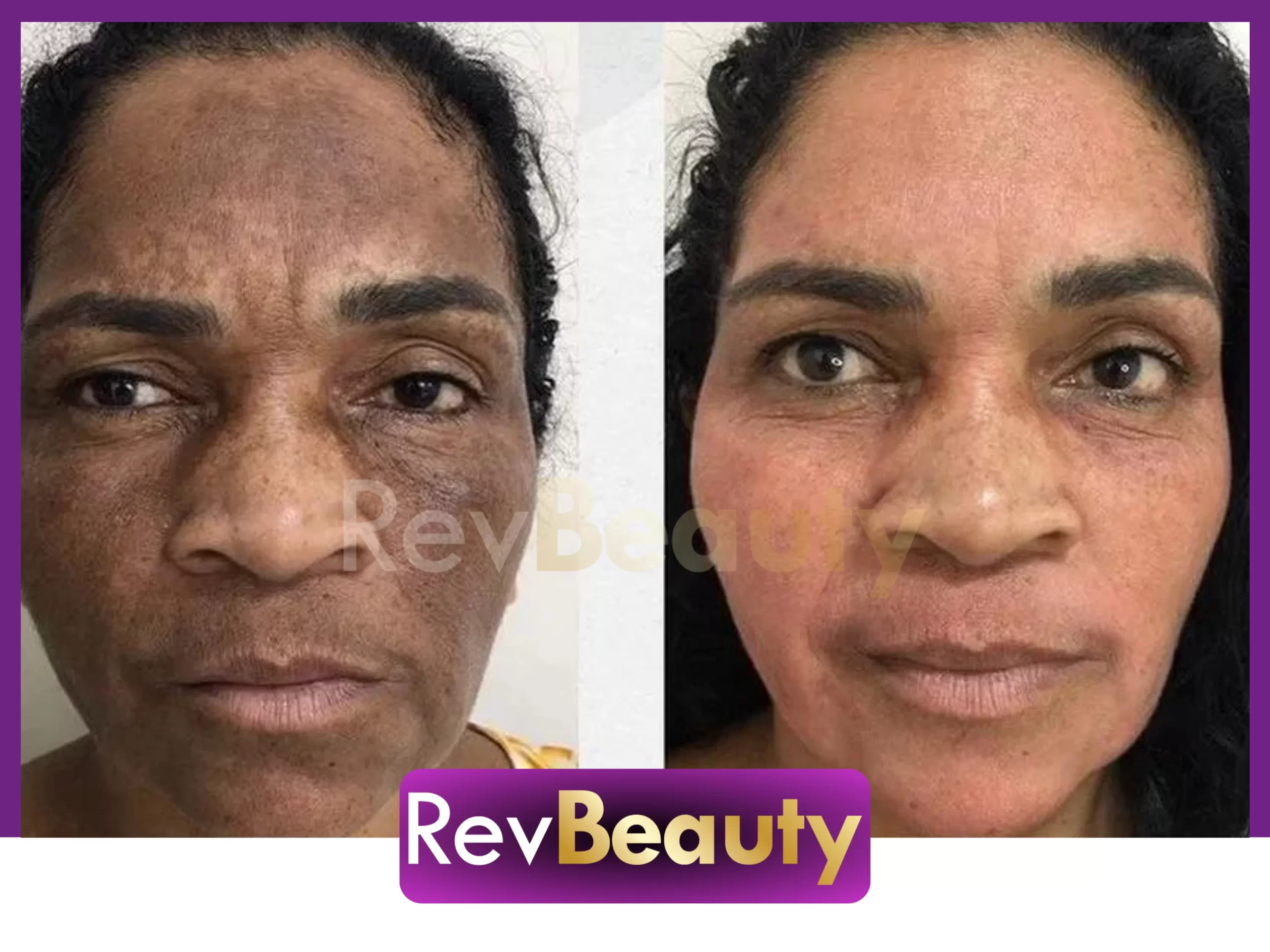 Resultados de clientes do RevBeauty.