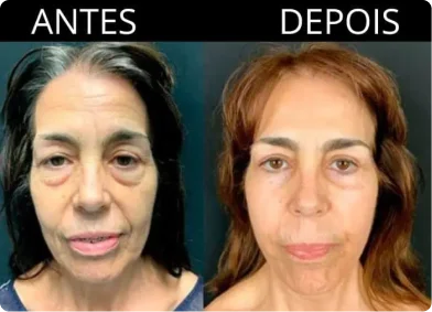 Resultados do Beauty Grow Max.