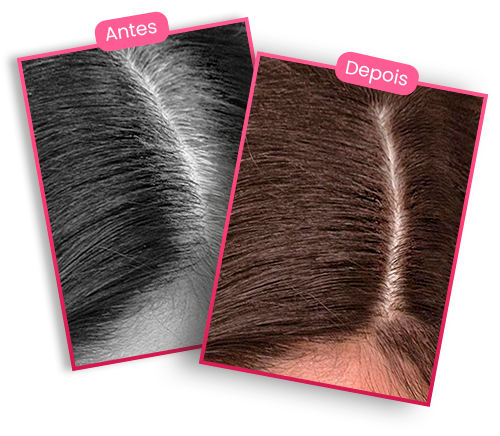 Antes e depois do uso do Biotin Hair.