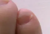 Close de uma unha natural com a cutícula visível
