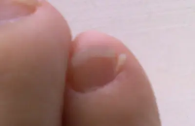 Close de uma unha natural com a cutícula visível