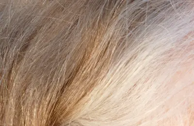 Cabelo em transição para o grisalho, com fios castanhos e brancos visíveis