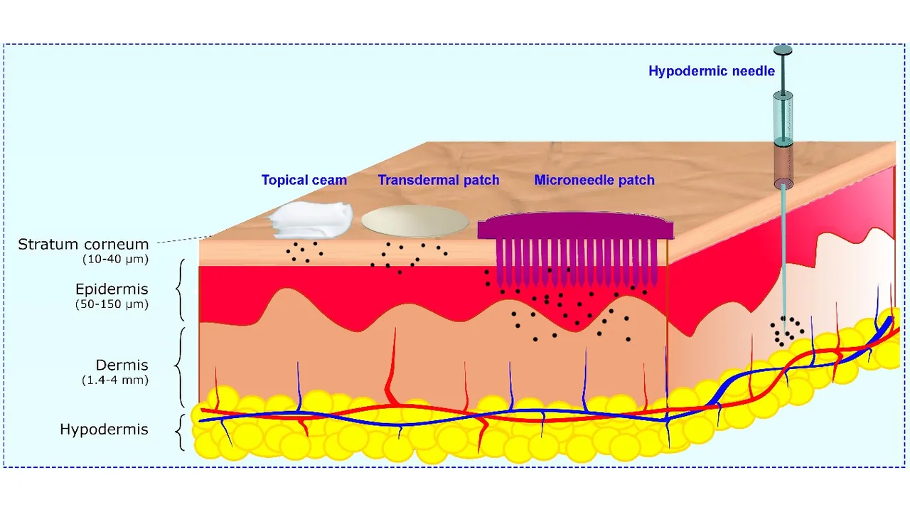 Diagrama mostra camadas da pele e a profundidade relativa de microagulhas