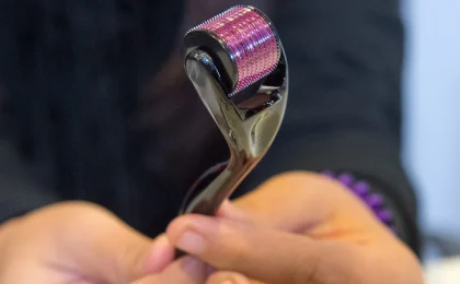 Microagulhamento com dermaroller em close, imagem de arquivo