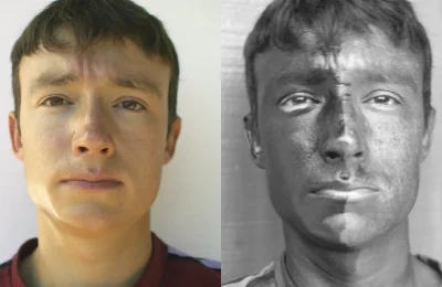 Comparação visual de um rosto com protetor solar sob luz visível e ultravioleta