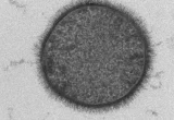 Imagem de Bacillus subtilis em microscopia eletrônica de transmissão, associado à produção microbiana de ácido poliglutâmico.