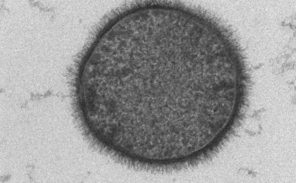 Imagem de Bacillus subtilis em microscopia eletrônica de transmissão, associado à produção microbiana de ácido poliglutâmico.