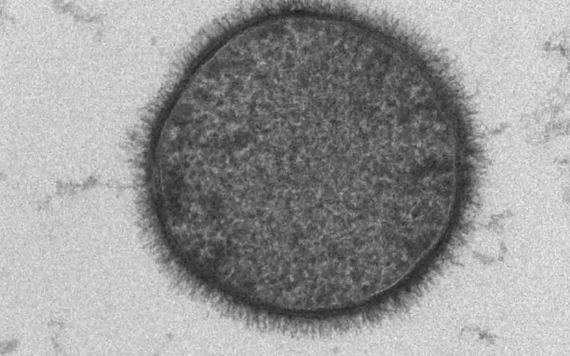 Imagem de Bacillus subtilis em microscopia eletrônica de transmissão, associado à produção microbiana de ácido poliglutâmico.